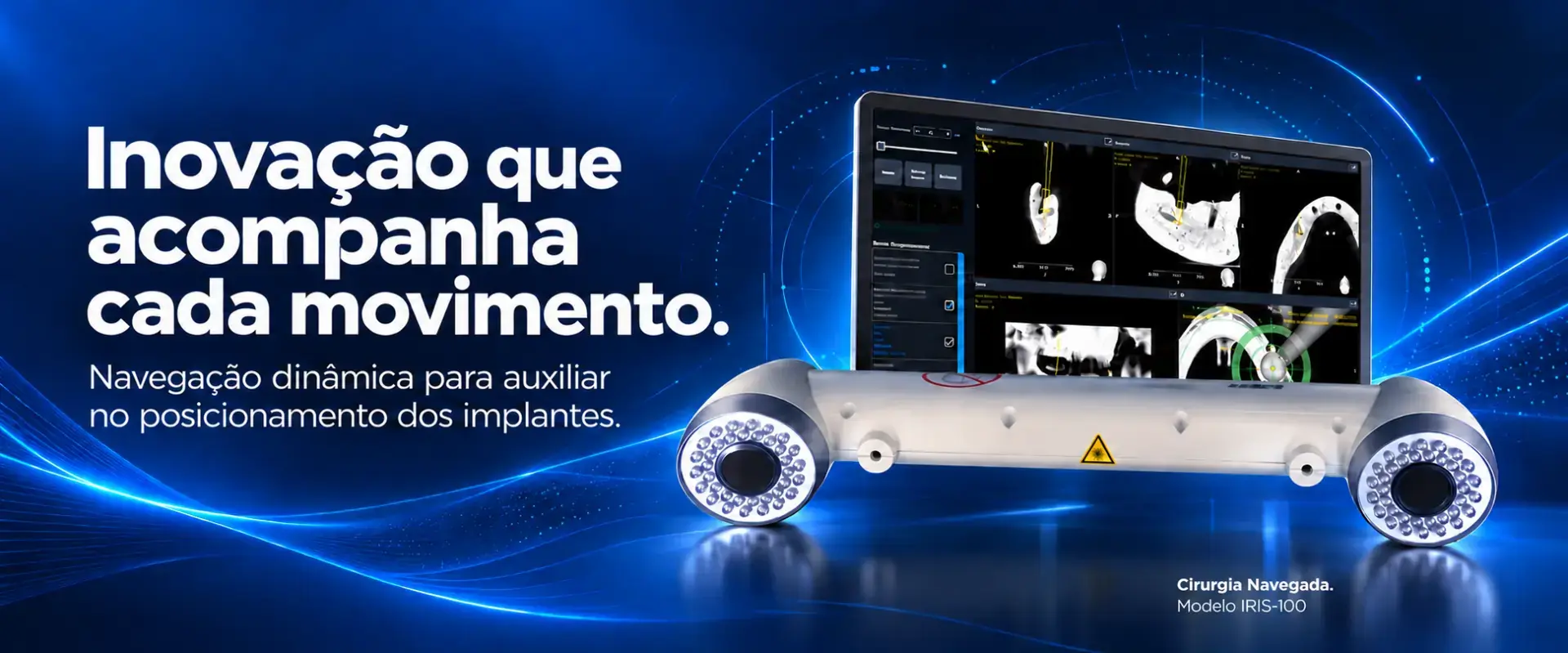 Sistema de cirurgia navegada IRIS 100